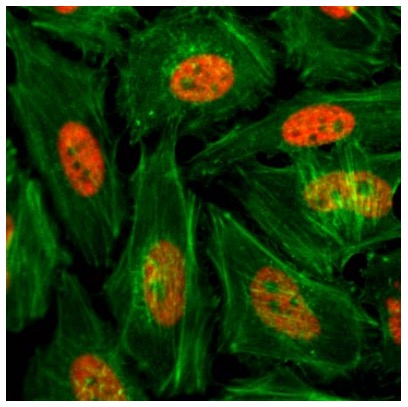 13-0026 Immunocytochemistry