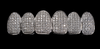 VVS1 Moissanite Single Tooth Cap - Gold