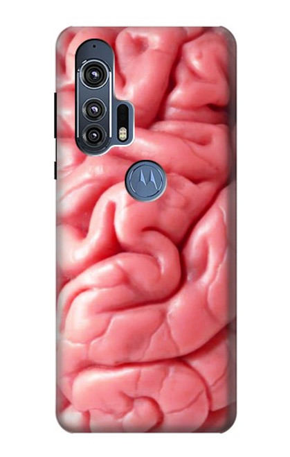 S0339 Brain Case For Motorola Edge+