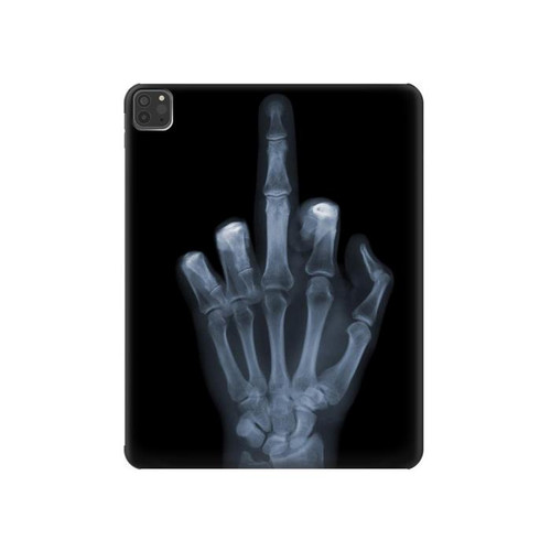 S1143 X-ray Hand Middle Finger Hard Case For iPad Pro 11 (2021,2020,2018, 3rd, 2nd, 1st)
