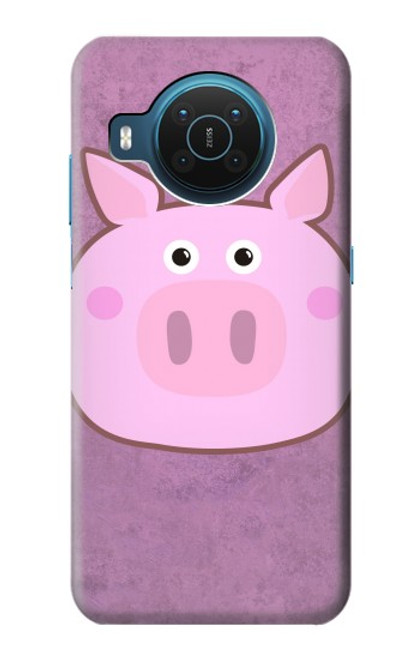 S3269 Pig Cartoon Case For Nokia X20
