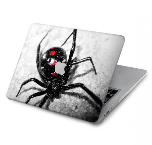 S2386 Black Widow Spider Hard Case For MacBook Pro 14 M1,M2,M3 (2021,2023) - A2442, A2779, A2992, A2918