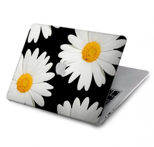 S2477 Daisy flower Hard Case For MacBook Pro 14 M1,M2,M3 (2021,2023) - A2442, A2779, A2992, A2918