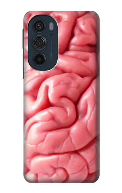 S0339 Brain Case For Motorola Edge 30 Pro
