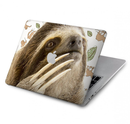 S3559 Sloth Pattern Hard Case For MacBook Air 13″ (2022,2024) - A2681, A3113
