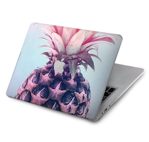 S3711 Pink Pineapple Hard Case For MacBook Air 15″ (2023,2024) - A2941, A3114