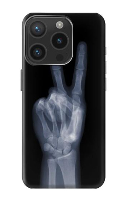 S3101 X-ray Peace Sign Fingers Case For iPhone 15 Pro