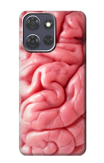 S0339 Brain Case For Motorola Moto G Power (2025,2026)