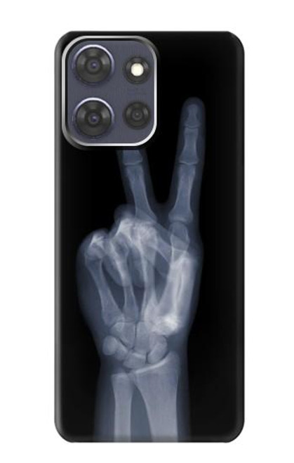 S3101 X-ray Peace Sign Fingers Case For Motorola Moto G Power (2025)