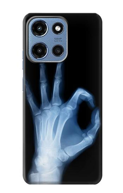 S3239 X-Ray Hand Sign OK Case For Motorola Moto G 5G (2025)