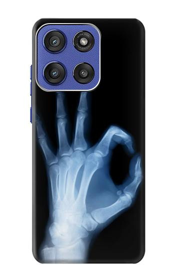 S3239 X-Ray Hand Sign OK Case For Motorola Moto G Stylus 5G (2025,2026), Edge 60 Stylus