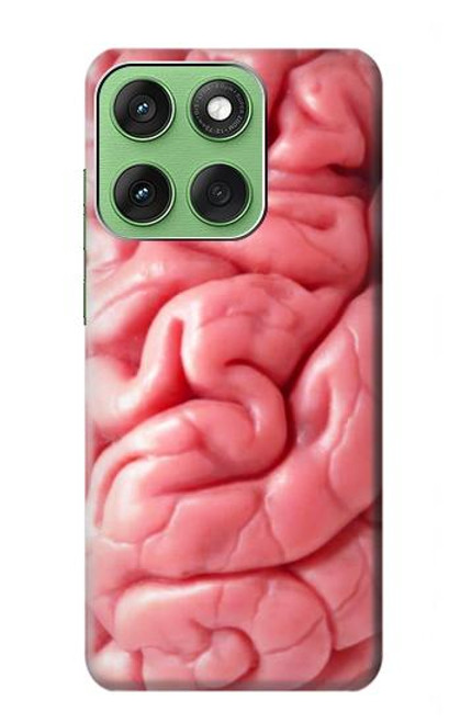 S0339 Brain Case For Motorola Edge 60