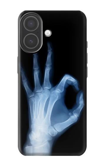 S3239 X-Ray Hand Sign OK Case For iPhone 17