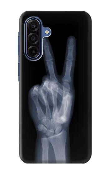 S3101 X-ray Peace Sign Fingers Case For Samsung Galaxy A17