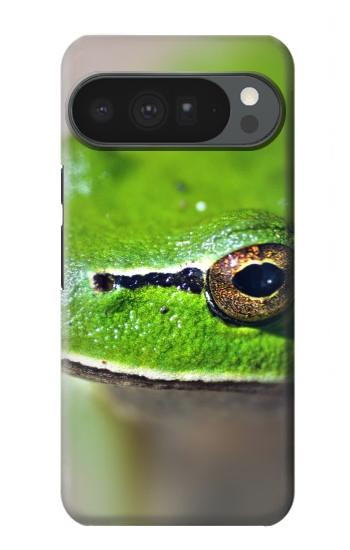 S3845 Green frog Case For Google Pixel 10 Pro XL