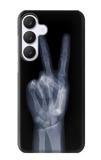 S3101 X-ray Peace Sign Fingers Case For Samsung Galaxy S25 FE