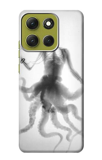 S1432 Skull Octopus X-ray Case For Motorola Moto G86