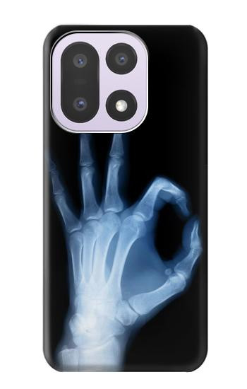 S3239 X-Ray Hand Sign OK Case For OnePlus 15