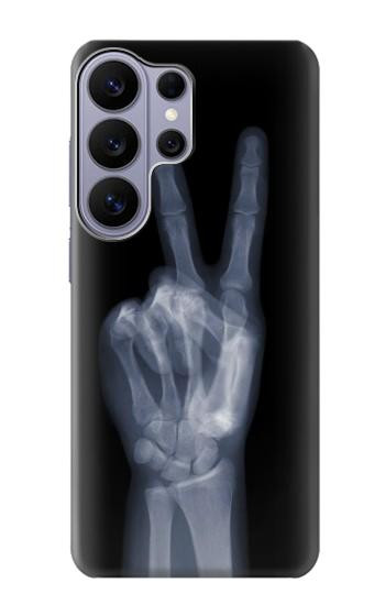 S3101 X-ray Peace Sign Fingers Case For Samsung Galaxy S26 Ultra