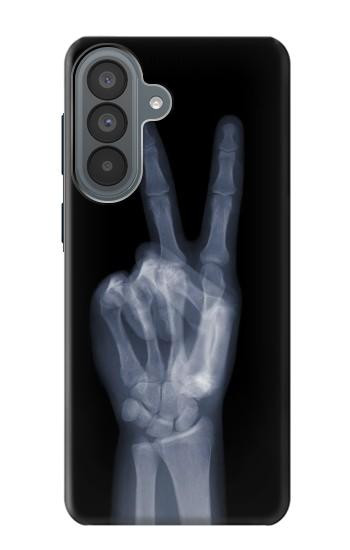 S3101 X-ray Peace Sign Fingers Case For Samsung Galaxy A37
