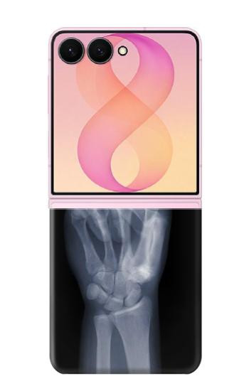 S3101 X-ray Peace Sign Fingers Case For Samsung Galaxy Z Flip 8