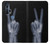 S3101 X-ray Peace Sign Fingers Case For Motorola Edge+