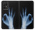 S3239 X-Ray Hand Sign OK Case For Samsung Galaxy A52, Galaxy A52 5G