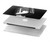 S1672 Retro Microphone Jazz Music Hard Case For MacBook 12″ - A1534