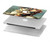 S1063 Napoleon Bonaparte Hard Case For MacBook Air 13″ - A1932, A2179, A2337
