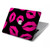 S2933 Pink Lips Kisses on Black Hard Case For MacBook Air 13″ - A1932, A2179, A2337