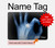 S3239 X-Ray Hand Sign OK Hard Case For MacBook Pro Retina 13″ - A1425, A1502