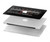 S3242 Analog Radio Tuning Hard Case For MacBook Pro Retina 13″ - A1425, A1502