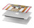 S2853 Jukebox Music Playing Device Hard Case For MacBook Pro 13″ - A1706, A1708, A1989, A2159, A2289, A2251, A2338