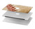S0064 Baseball Hard Case For MacBook Pro 15″ - A1707, A1990