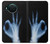 S3239 X-Ray Hand Sign OK Case For Nokia X10