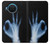 S3239 X-Ray Hand Sign OK Case For Nokia X20