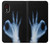 S3239 X-Ray Hand Sign OK Case For Samsung Galaxy Xcover 5 S3239 X-Ray Hand Sign OK Case For Samsung Galaxy Xcover 5