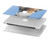S3806 Funny Giraffe Hard Case For MacBook Pro 14 M1,M2,M3 (2021,2023) - A2442, A2779, A2992, A2918