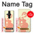 S0815 Pregnant Art Case For Sony Xperia Pro-I