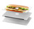 S0790 Hamburger Hard Case For MacBook Air 13″ (2022,2024) - A2681, A3113