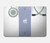 S3801 Doctor Suit Hard Case For MacBook Air 13″ (2022,2025) - A2681, A3113, A3240