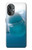 S1801 Beluga Whale Smile Whale Case For OnePlus Nord N20 5G