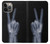 S3101 X-ray Peace Sign Fingers Case For iPhone 14 Pro