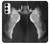 S1593 Ballet Pointe Shoe Case For Samsung Galaxy S23 S1593 Ballet Pointe Shoe Case For Samsung Galaxy S23