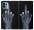 S1143 X-ray Hand Middle Finger Case For Motorola Edge+ (2023), X40, X40 Pro, Edge 40 Pro