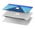 S2429 Swimming Pool Hard Case For MacBook Air 15″ (2023,2024,2025) - A2941, A3114, A3241