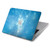 S2923 Frozen Snow Spell Magic Hard Case For MacBook Air 15″ (2023,2024,2025) - A2941, A3114, A3241