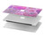 S3710 Pink Love Heart Hard Case For MacBook Air 15″ (2023,2024,2025) - A2941, A3114, A3241