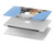 S3806 Funny Giraffe Hard Case For MacBook Air 15″ (2023,2024) - A2941, A3114