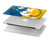 S3857 Peace Dove Ukraine Flag Hard Case For MacBook Air 15″ (2023,2024) - A2941, A3114